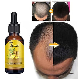 7 Day Ginger Hair Growth Oil - Free Delivery -